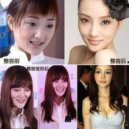 北京整容爆料案件最新,揭开医美行业潜规则与维权困境 第2张 北京整容爆料案件最新,揭开医美行业潜规则与维权困境 第2张